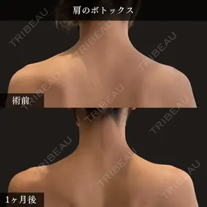 PRISM Beauty Clinic 畑山 知輝医師の症例
