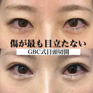 グローバルビューティークリニック 銀座院 理事長　杉崎　裕斗医師の症例