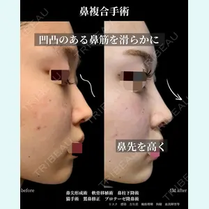 グローバルビューティークリニック 大阪院の症例