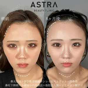 ASTRA BEAUTY CLINIC 塩満 惠子医師の症例