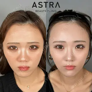 ASTRA BEAUTY CLINIC 塩満 惠子医師の症例