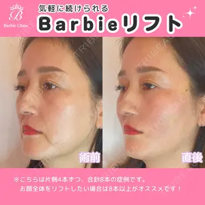 Barbie Clinic みすみ医師の症例