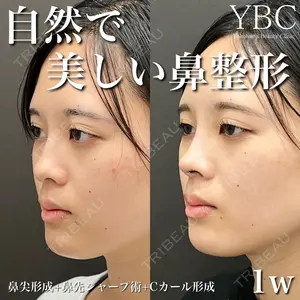 YBC横浜美容外科 大宮院 磯村 亮輔医師の症例