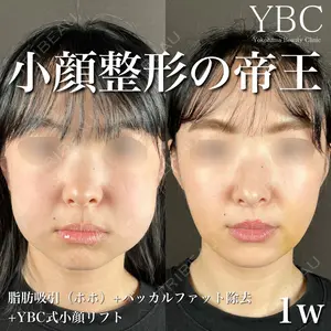 YBC横浜美容外科 大宮院 磯村 亮輔医師の症例