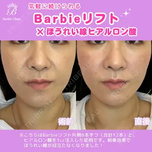 Barbie Clinic みすみ医師の症例