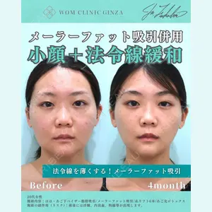 WOM CLINIC GINZA （ワム クリニック ギンザ） 深堀 純也医師の症例