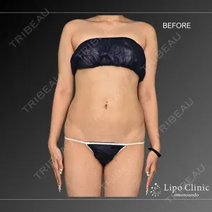 Lipo Clinic omotesando 福田 越医師の症例