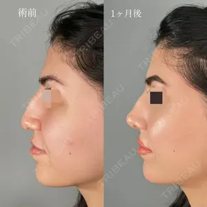ASTRA BEAUTY CLINIC 河口 はるか医師の症例