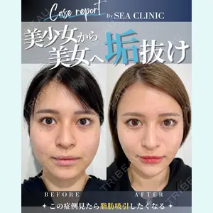 SEA CLINIC（シークリニック） 沼澤 茂医師の症例