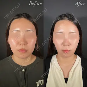 R Beauty CLINIC 大阪院 小池 泰弘医師の症例