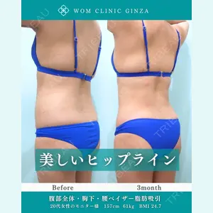 症例