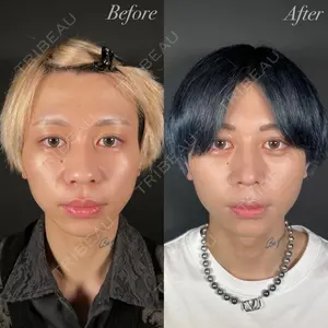 R Beauty CLINIC 大阪院 小池 泰弘医師の症例