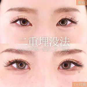 症例