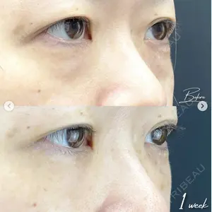 湘南美容クリニック 浜松院の症例