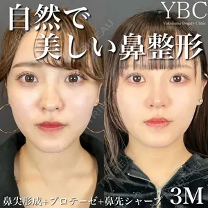 YBC横浜美容外科 大宮院 磯村 亮輔医師の症例