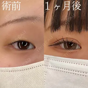 HAAB×DREAM BEAUTY CLINIC 大阪梅田院 柏木 太雅医師の症例