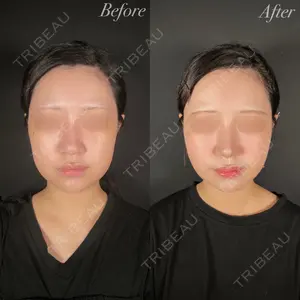 R Beauty CLINIC 大阪院 小池 泰弘医師の症例