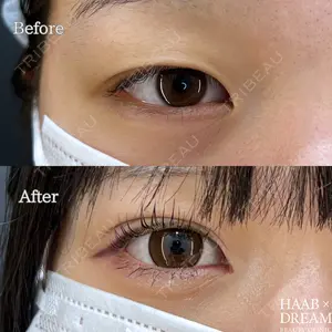 HAAB×DREAM BEAUTY CLINIC 東京本院 田中 優太医師の症例