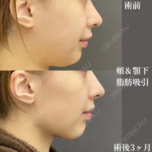 お茶の水美容形成クリニック 吉井 健吾医師の症例