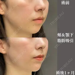 症例