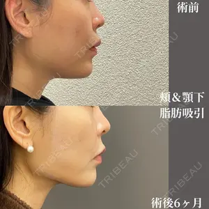 症例