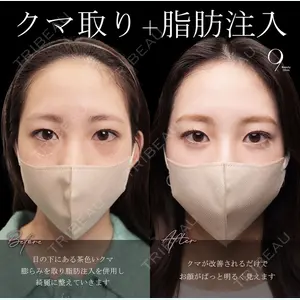 9BeautyClinic 池田 陸医師の症例