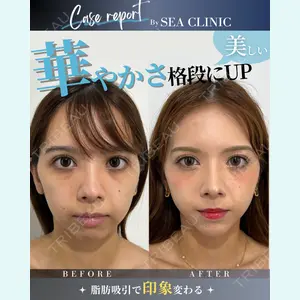 SEA CLINIC（シークリニック） 沼澤 茂医師の症例