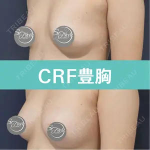 症例