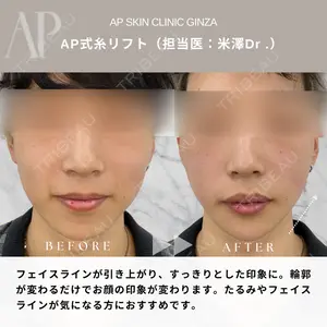 症例