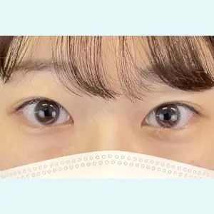 症例