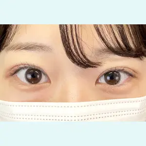 症例
