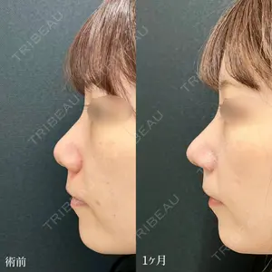 東京シンデレラ美容外科 大宮院の症例