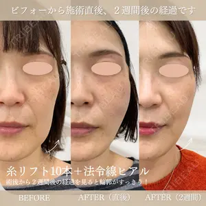症例