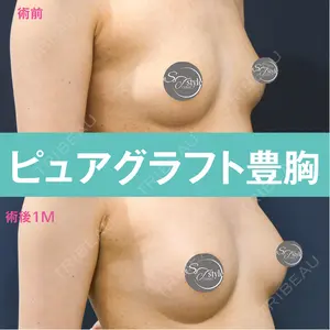 症例