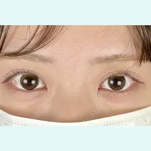 症例