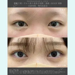 湘南美容クリニック 金山院の症例