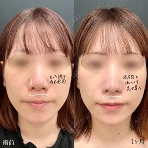 東京シンデレラ美容外科 大宮院の症例