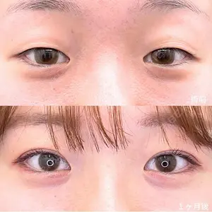 症例