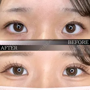ルラ美容クリニック 高田馬場院 若佐 卓矢医師の症例