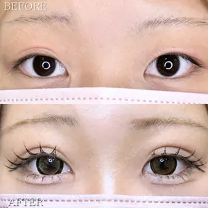 ルラ美容クリニック 高田馬場院 若佐 卓矢医師の症例