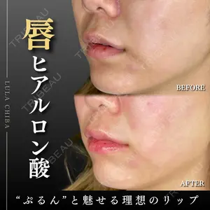 ルラ美容クリニック 千葉院 下川 洋輝医師の症例