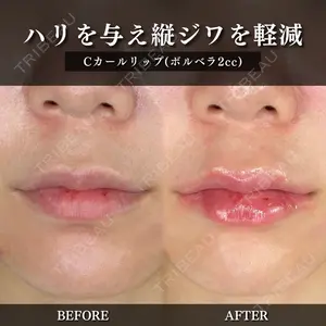 ルラ美容クリニック 千葉院 下川 洋輝医師の症例