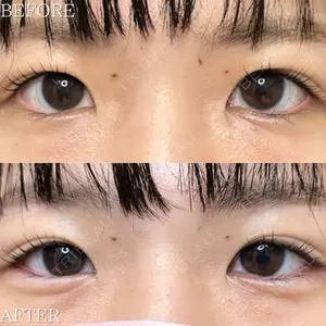 ルラ美容クリニック 高田馬場院 若佐 卓矢医師の症例