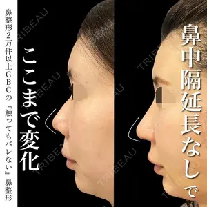 グローバルビューティークリニック 銀座院 理事長　杉崎　裕斗医師の症例