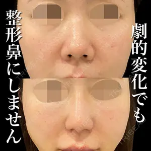 グローバルビューティークリニック 銀座院 理事長　杉崎　裕斗医師の症例