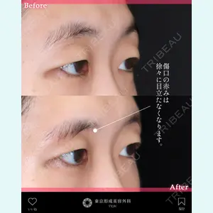 東京形成美容外科 船橋院 弓削田　浩主医師の症例