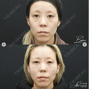 湘南美容クリニック 松戸院の症例