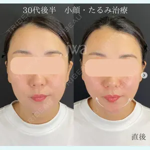 自由が丘ウェルエイジングビューティークリニック 福田 知佐子医師の症例
