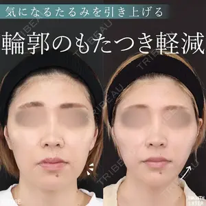 症例