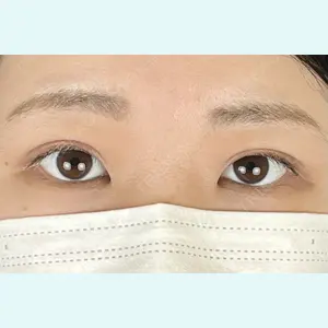 症例